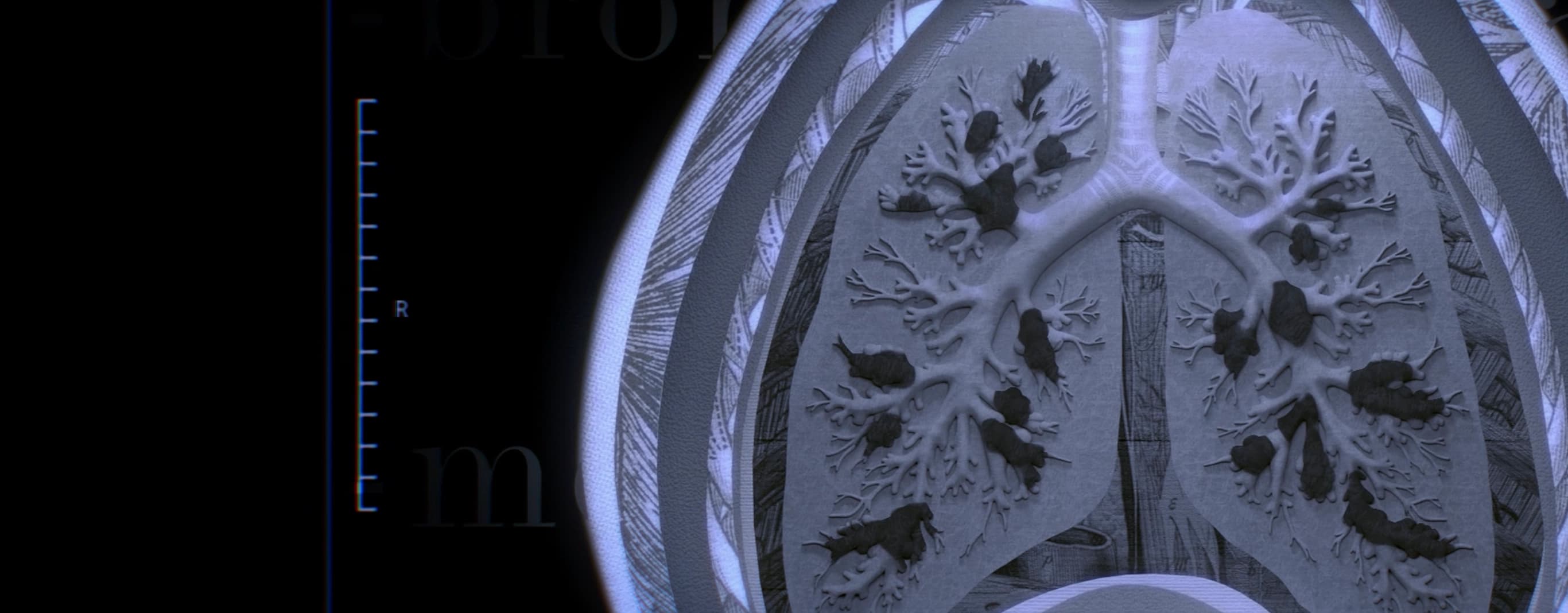 Diagnosing BE Hero Image